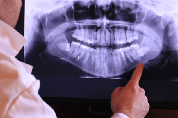 Best Emergency Treatment for Dental Infections or Abscesses in Leith Hatfield, PA