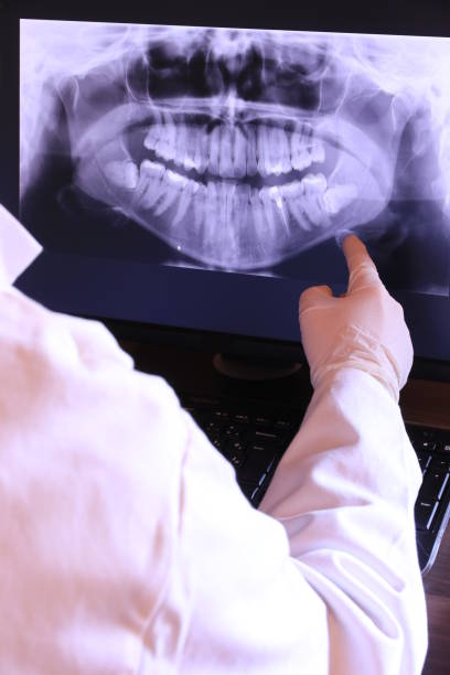 Best Emergency Tooth Extraction in Leith Hatfield, PA